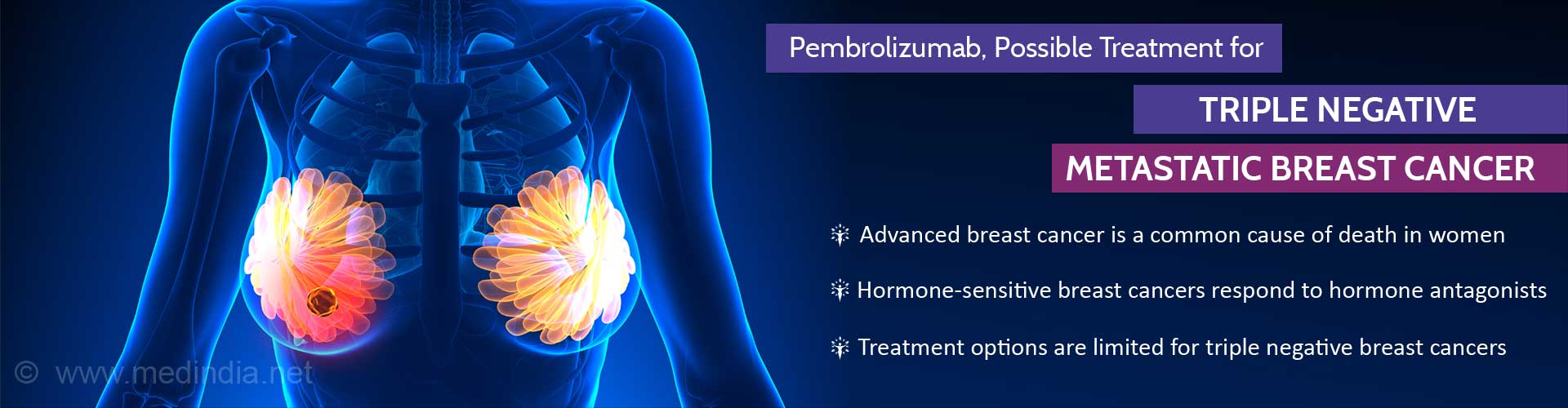 Pembrolizumab, possible treatment for triple negative metastatic breast cancer
- Advanced breast cancer is a common cause of death in women
- Hormone-sensitive breast cancers respond to hormone antagonists
- Treatment options are limited for triple negative breast cancers