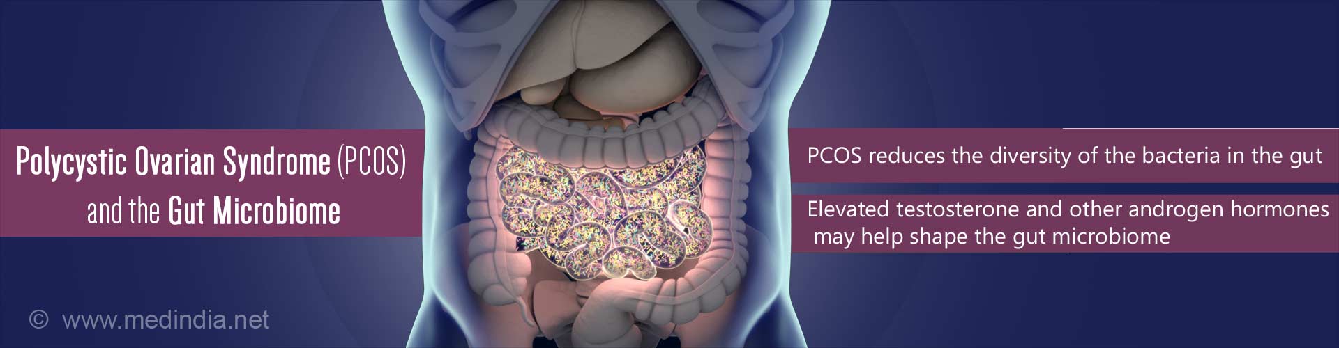 Polycystic ovarian syndrome (PCOS) and the gut microbiome
- PCOS reduces the diversity of the bacteria in the gut
- elevated testosterone and other androgen hormones may help shape the gut microbiome
