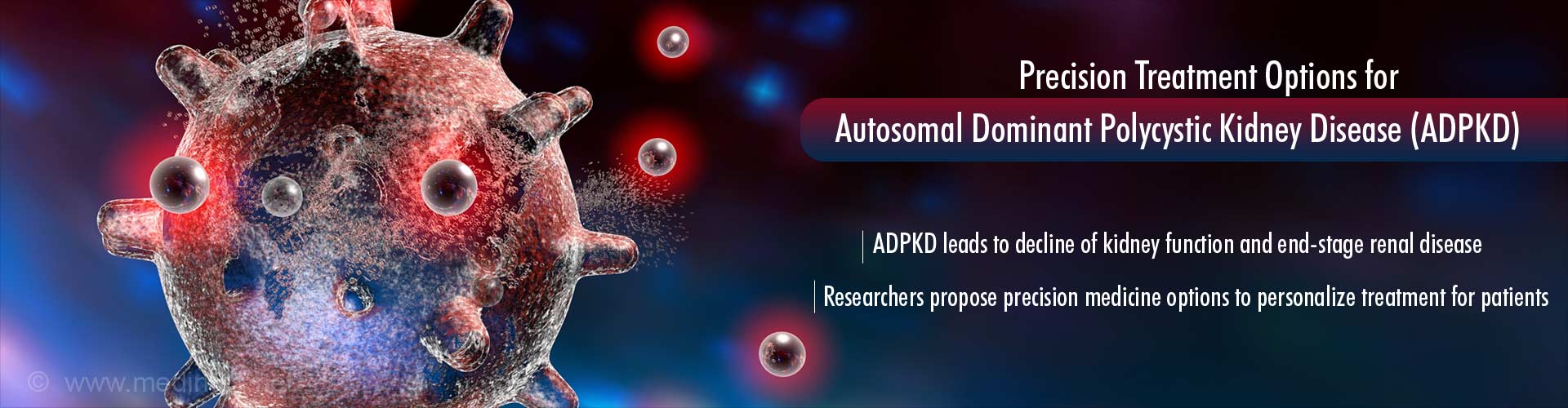 Precision treatment options for autosomal dominant polycystic kidney disease (ADPKD)
- ADPKD leads to decline of kidney function and end-stage renal disease
- Researchers propose precision medicine options to personalize treatment for patients