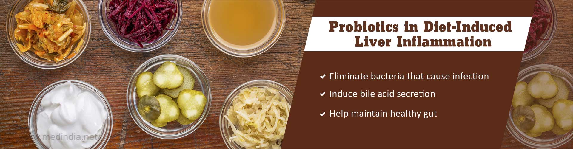 Probiotics in Diet-Induced Liver Inflammation
- Eliminate bacteria that cause infection
- Induce bile acid secretion
- Help maintain healthy gut