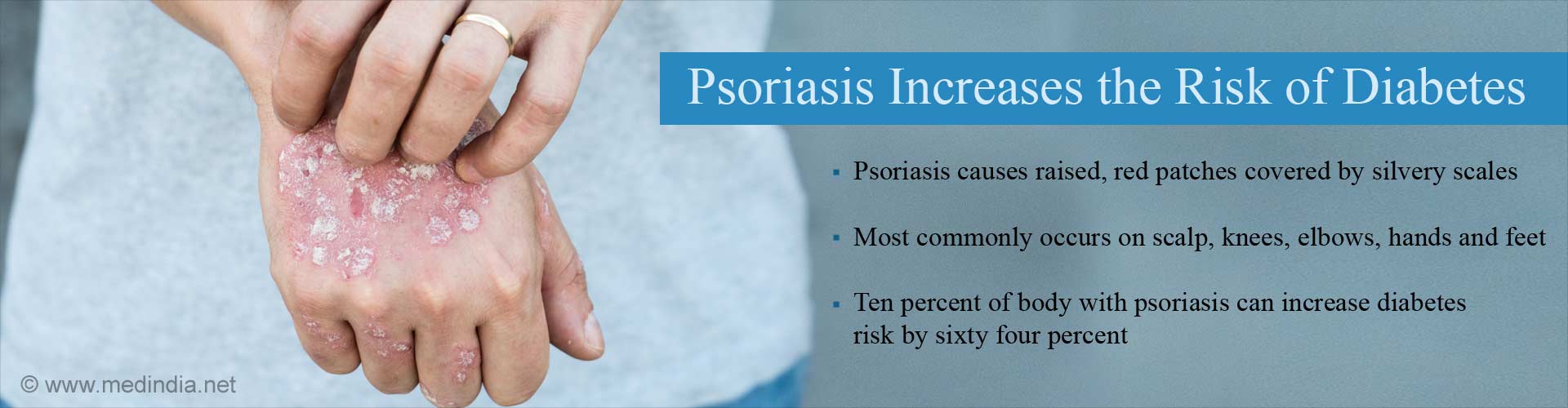Psoriasis increases the risk of diabetes
- Psoriasis causes raised, red patched covered by silvery scales
- Most commonly occurs on scalp, knees elbows, hands and feet
- Ten percent of body with psoriasis can increase diabetes risk by sixty four percent
