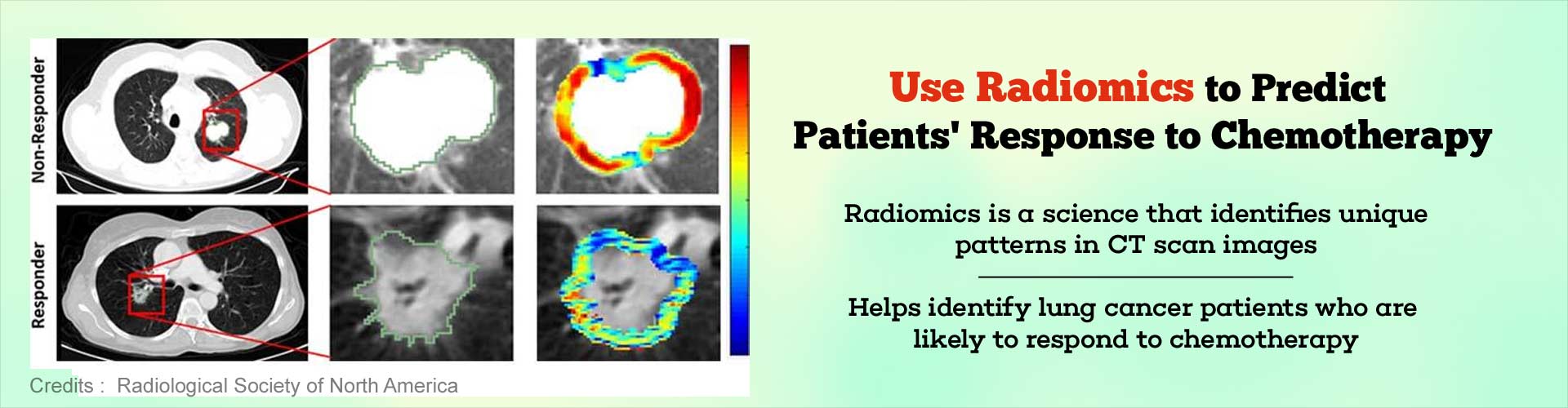 Use Radiomics to predict patients' response to chemotherapy. Radiomics is a science that identifies unique patterns in CT scan images. Helps identify lung cancer patients who are likely to respond to chemotherapy.