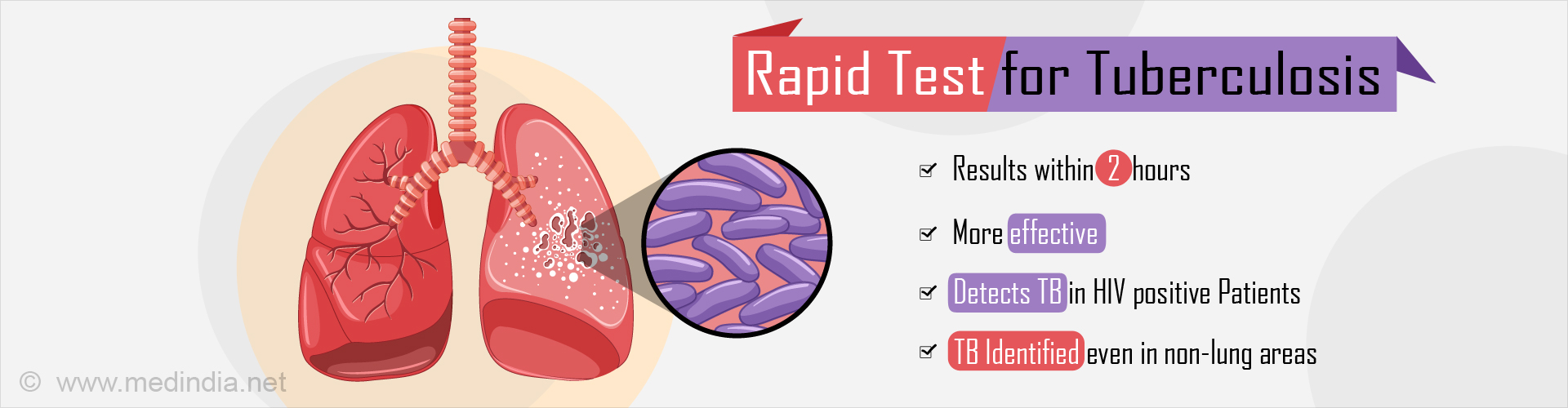 Rapid Test for Tuberculosis
- Results within 2 hours
- More effective
- Detects TB in HIV +ve patients
- TB Identified even in non-lung areas