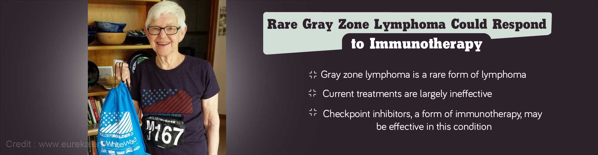 Rare gray zone lymphoma could respond to immunotherapy
- Gray zone lymphoma is a rare form of lymphoma
- Current treatments are largely ineffective
- Checkpoint inhibitors, a form of immunotherapy, may be effective in this condition