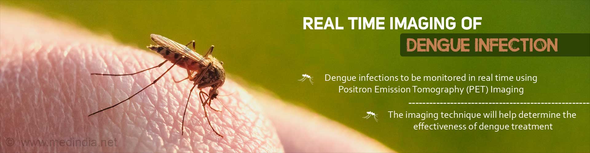 Real time imaging of dengue infection
- Dengue infections to be monitored in real time using Positron Emission Tomography (PET) Imaging
- The imaging technique will help determine the effectiveness of dengue treatment