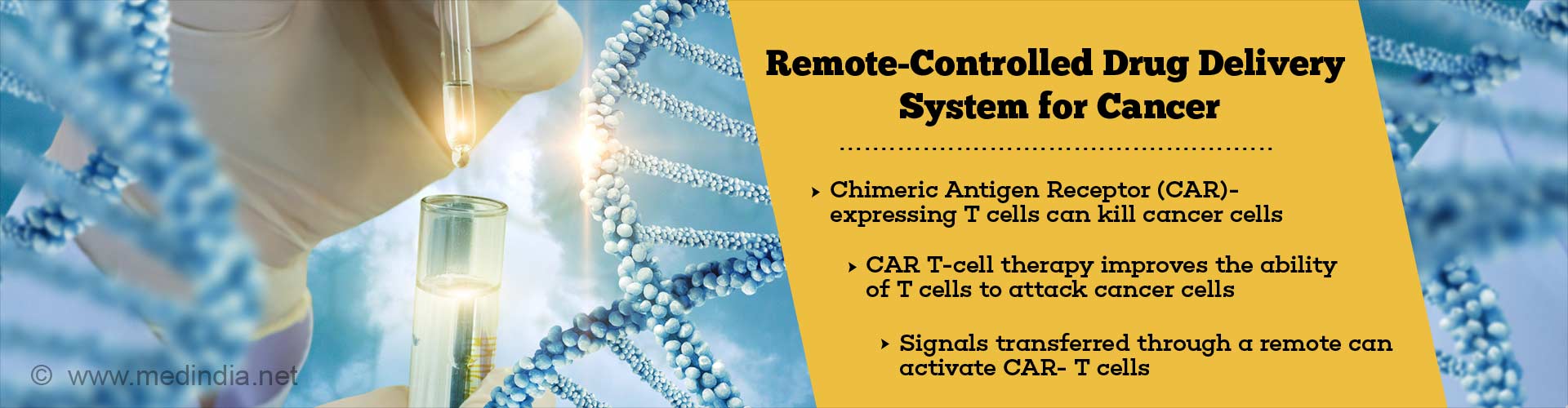 remote-controlled drug delivery system for cancer
- chimeroc antigen receptor (CAR) T cells can kill cancer cells
- CAR T-cell therapy improves the ability of T cells to attack cancer cells
- signals transferred through a remote can activate CAR- T cells
