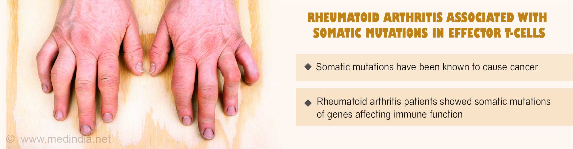 Rheumatoid arthritis associated with somatic mutations in effector T- cells
- Somatic mutations have been known to cause cancer
- Rheumatoid arthritis patients showed somatic mutations of genes affecting immune function