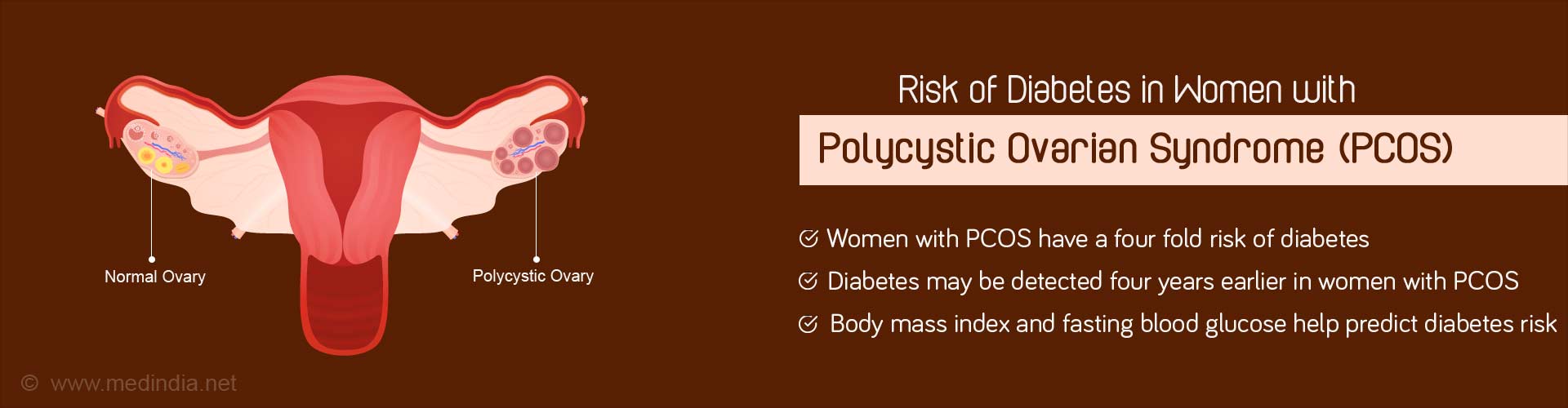 Risk of diabetes in women with polycystic ovarian syndrome (PCOS)
- women with PCOS have a four fold risk of diabetes
- diabetes may be detected four years earlier in women with PCOS
- body mass index and fasting blood glucose help predict diabetes risk