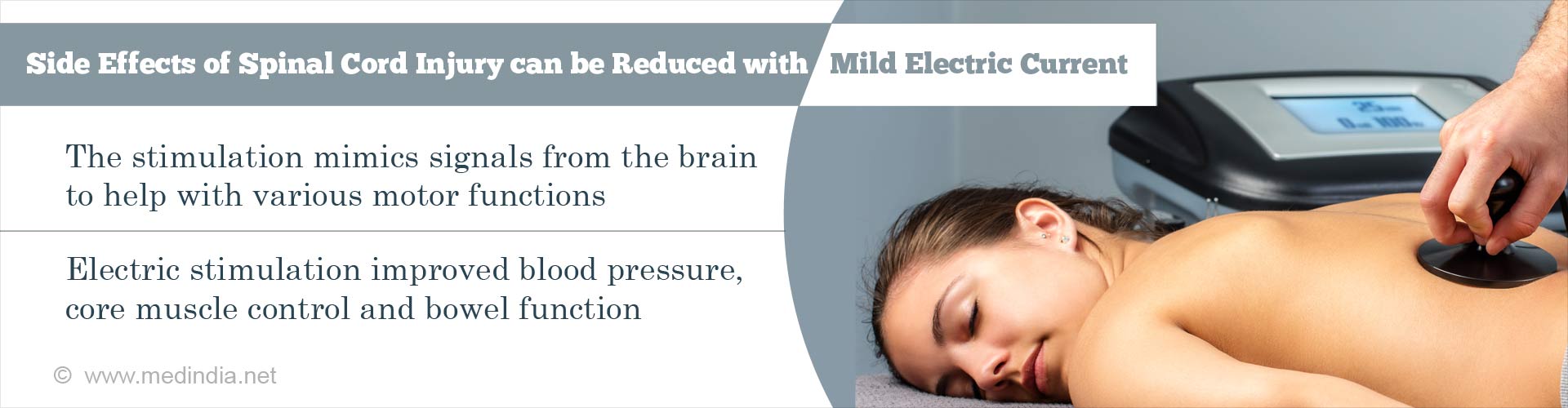 side effects of spinal cord injury can be reduced with mild electric current
- the stimulation mimics signals from the brain to help with various motor functions
- electric stimulation improved blood pressure, core muscle control and bowel function 