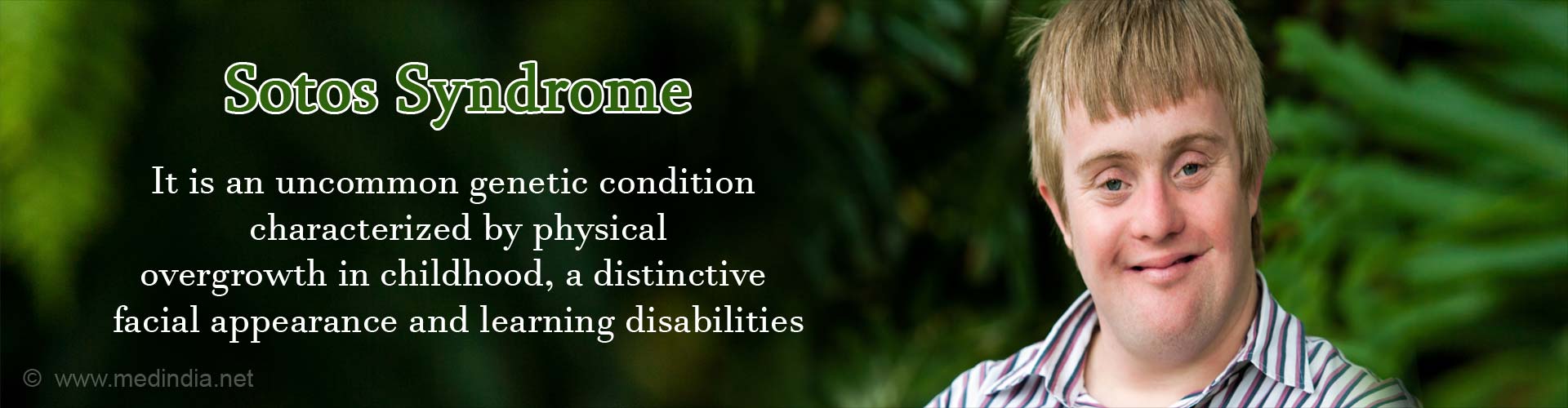 Sotos Syndrome - It is an uncommon genetic condition characterized by physical over-growth in childhood, a distinctive facial appearance and learning disabilities