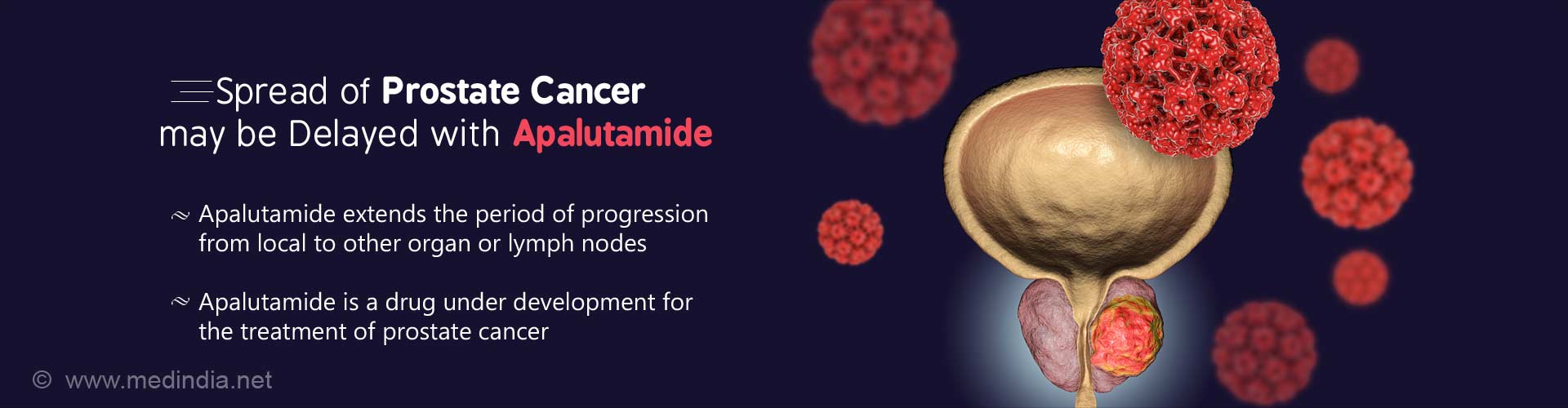 spread of prostate cancer may be delayed with apalutamide
- apalutamide extends the period of progression from local to other organ and lymph nodes
- apalutamide is a drug under development for the treatment of prostate cancer