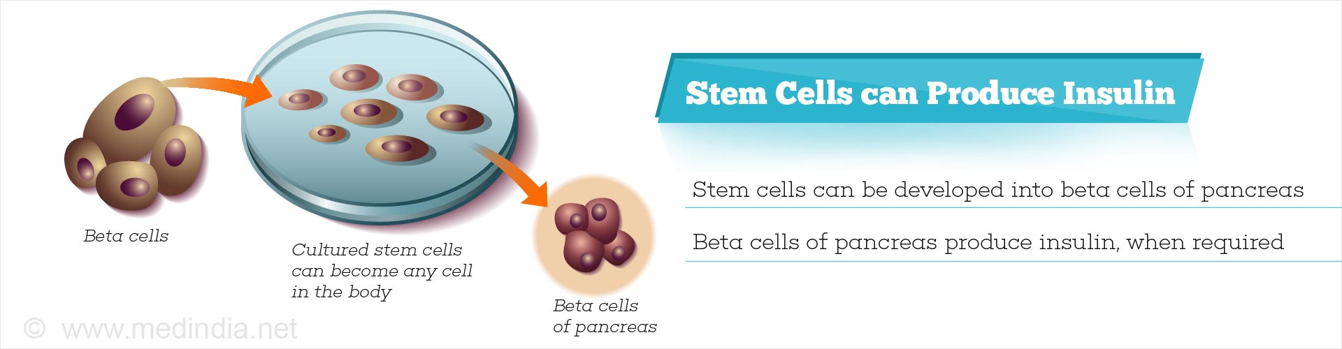 Stem cells can produce insulin
- Stem cells can be developed into beta cells of pancreas
- Beta cells of pancreas produce insulin, when required
