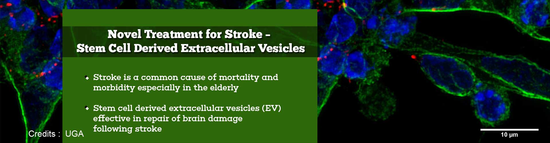 novel treatment for stroke - stem cell derived extracellular vesicles
- stroke is a common cause of mortality and morbidity especially in the elderly
- stem cell derived extracellular vesicles (EV) effective in repair of brain damage following stroke