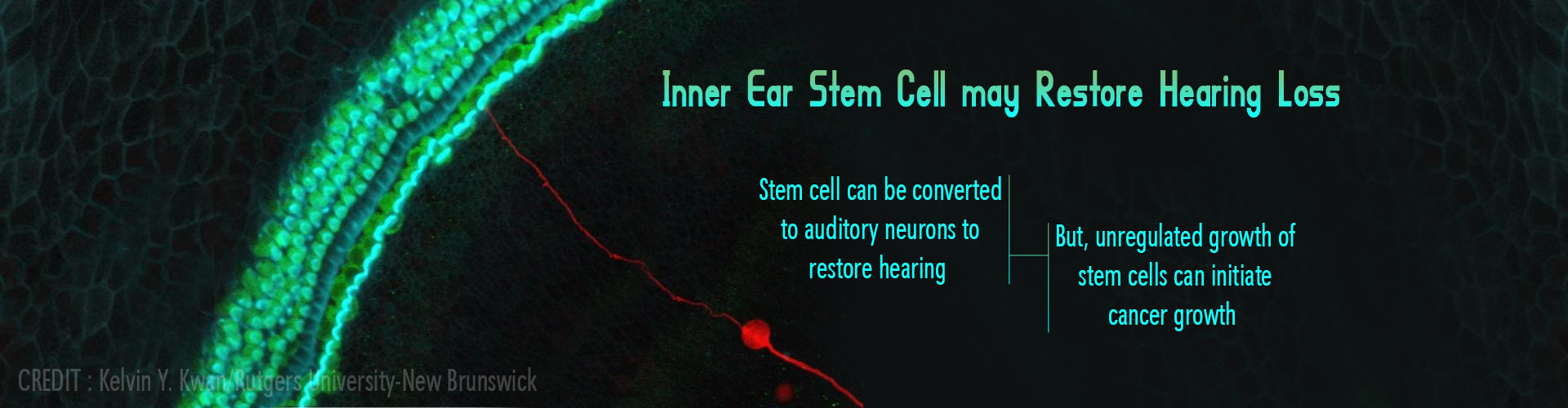 inner ear stem cells may restore hearing loss
- stem cells can be converted to auditory neurons to restore hearing
- unregulated growth of stem cells can initiate cancer growth