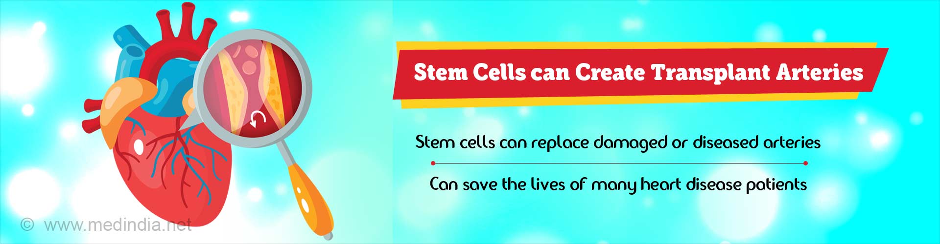 Stem cells can create transplant arteries. Stem cells can replace damaged or diseased arteries. Can save the lives of many heart disease patients.