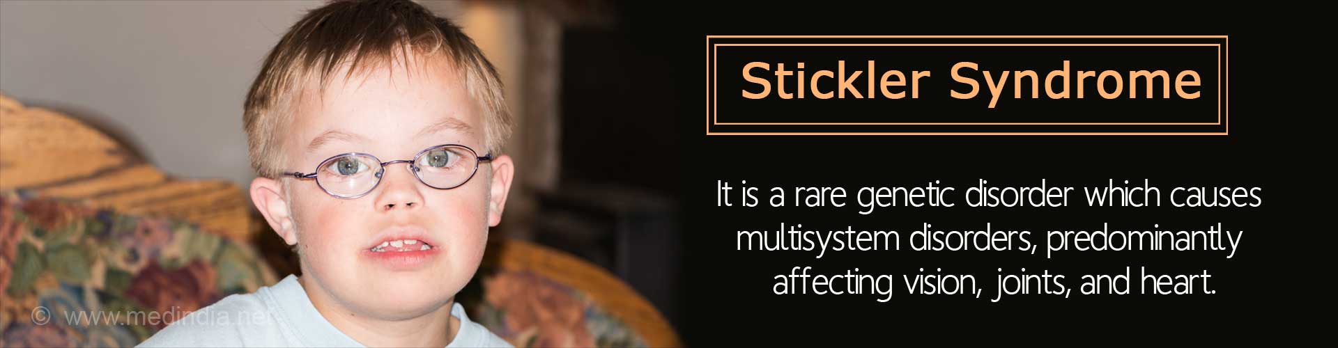 Stickler Syndrome - It is a rare genetic disorder which causes multisystem disorders, predominantly affecting vision, joints, and heart
