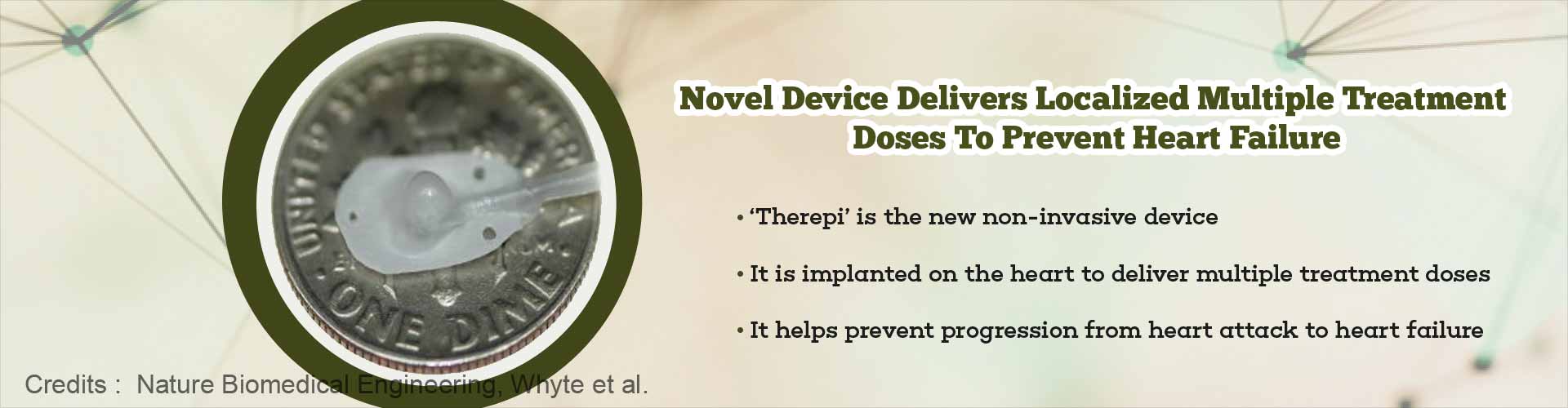 New Device Implanted on Heart Prevents Heart Failure