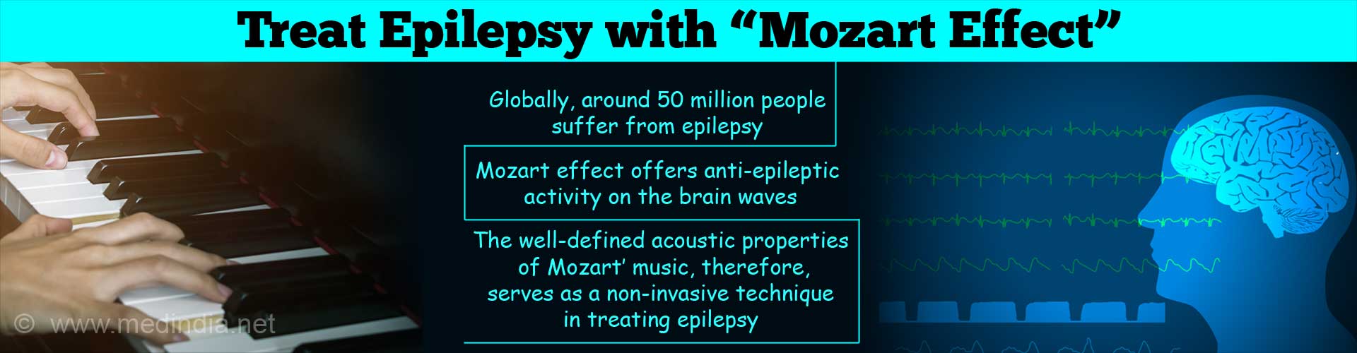 Epilepsy can be Treated by the â€œMozart Effectâ€