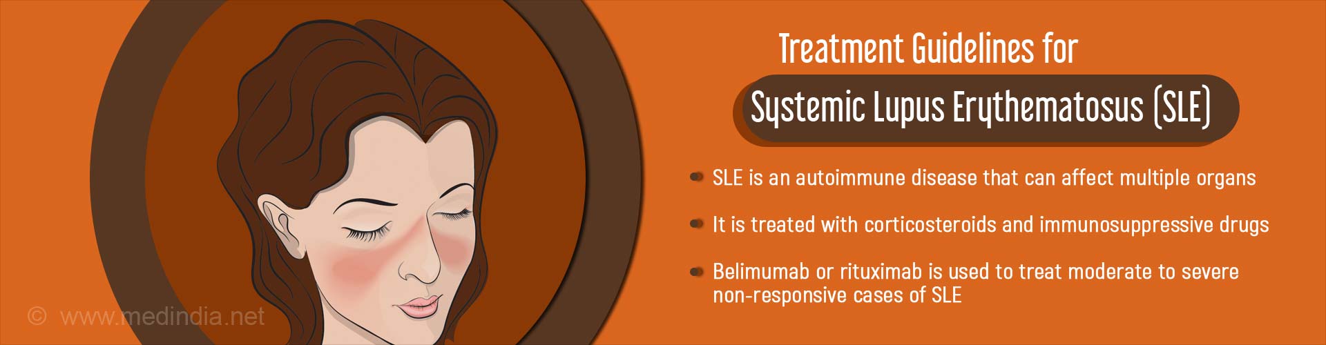 Treatment guidelines for systemic lupus erythematosus (SLE)
- SLE is an autoimmune disease that can affect multiple organs
- It is treated with corticosteriods and immunosuppressive drugs
- Belimumab or rituimab is used to treat moderate to severe non-responsive cases of SLE