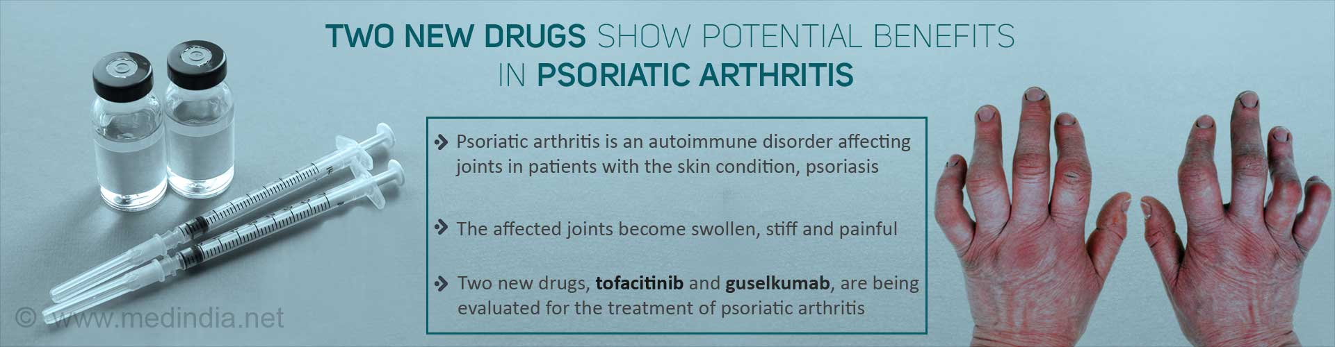Two new drugs show potential benefits in psoriatic arthritis
- Psoriatic arthritis is an autoimmune disorder affecting joints in patients with the skin condition, psoriasis
- The affected joints become swollen, stiff ans painful
- Two new drugs, tofacitinib and guselkumab, are being evaluated for the treatment of psoriatic arthritis