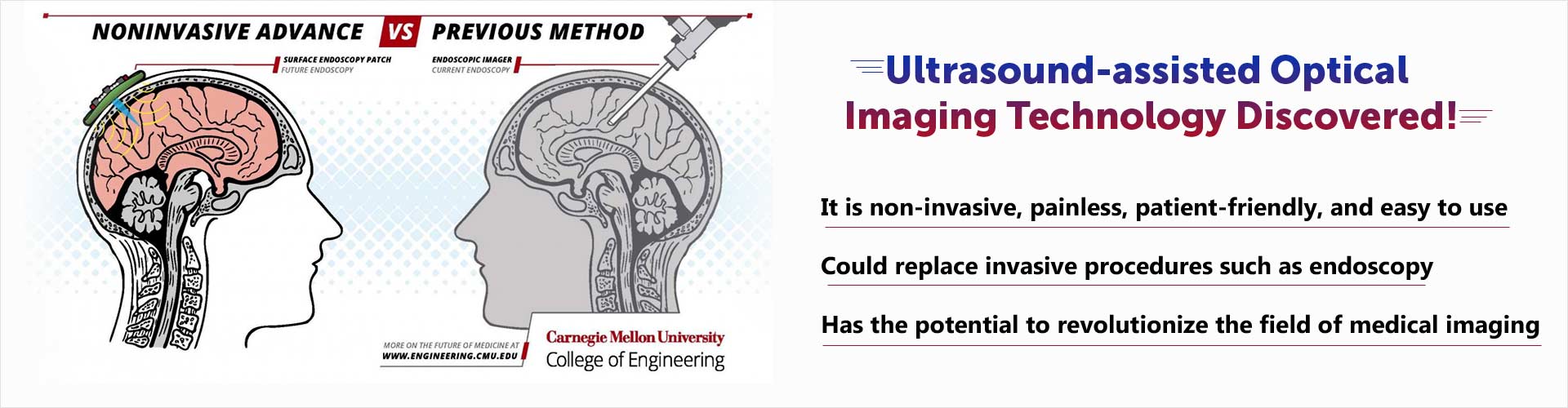 Ultrasound-assisted optical imaging technology discovered. It is non-invasive, painless, patient-friendly, and easy to use. Could replace invasive procedures such as endoscopy. Has the potential to revolutionize the field of medical imaging.