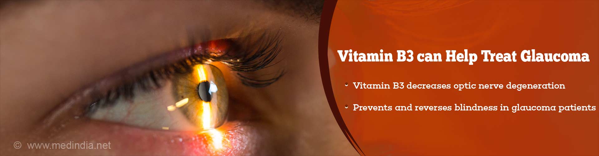 vitamin b3 can help treat glaucoma
- vitamin b3 decreases optic nerve degeneration
- prevents and reverses blindness in glaucoma patients
