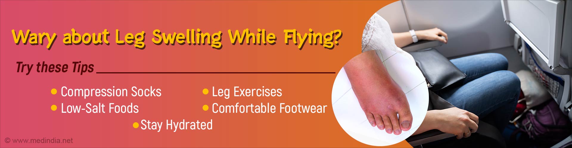 Why Does Foot Swelling Occur While Flying?
