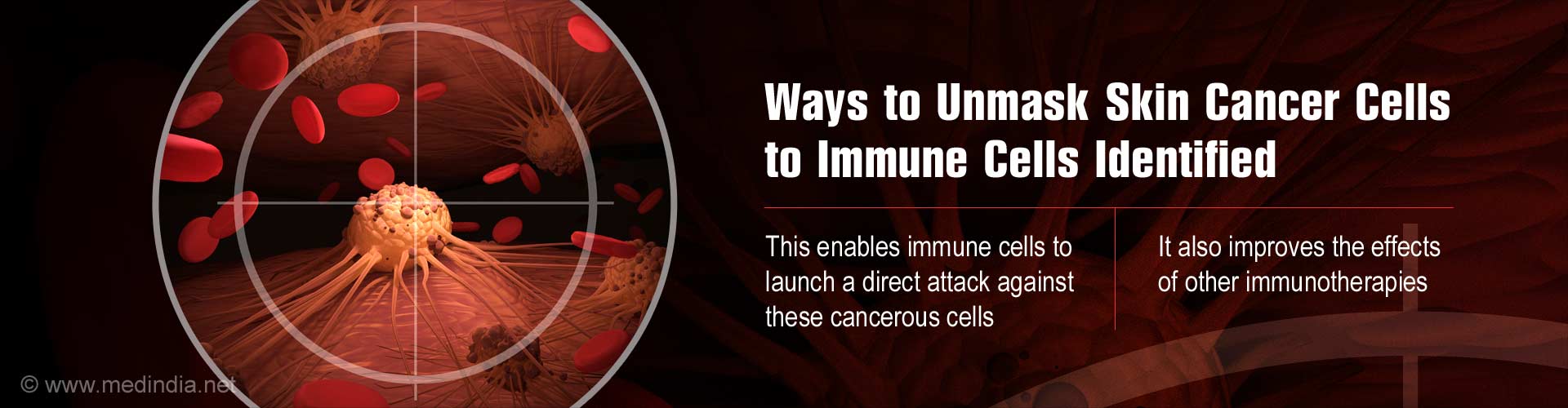 ways to unmask skin cancer cells to immune cells identified
- this enables immune cells to launch a direct attack against these cancerous cells
- it also improves the effects of other immunotherapies
