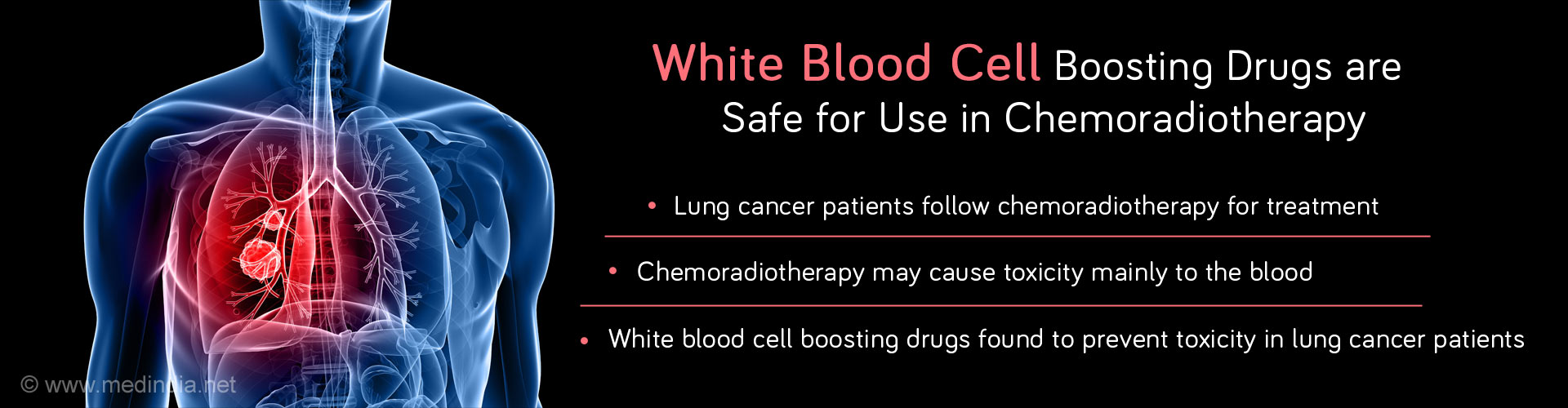 White blood cell boosting drugs are safe for use in chemoradiotherapy
- Lunch cancer patients follow chemoradiotherapy for treatment
- Chemoradiotherapy may cause toxicity mainly to the blood
- White blood cells boosting drugs found to prevent toxicity in lung cancer patients