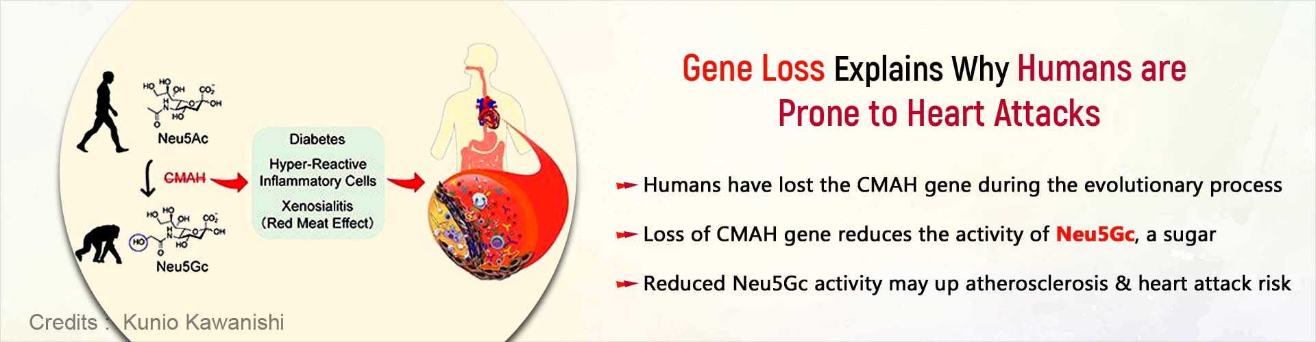 Gene loss explains why humans are prone to heart attacks. Humans have lost the CMAH gene during the evolutionary process. Loss of CMAH gene reduces the activity of Neu5Gc, a sugar. Reduced Neu5Gc activity may up atherosclerosis and heart attack risk.