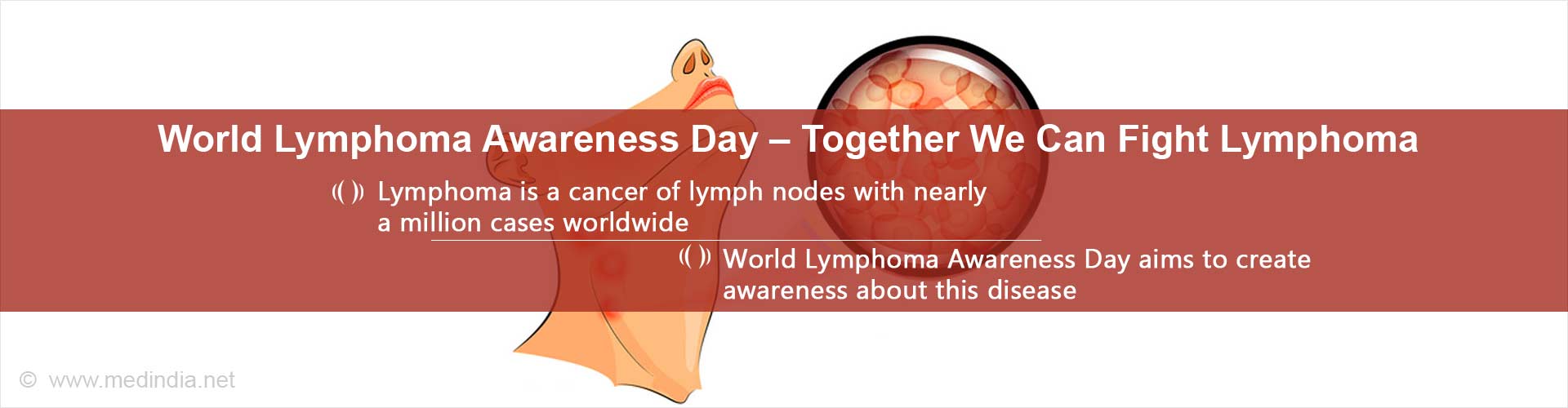 World Lymphoma Awareness Day: Together We can Fight Lymphoma
- Lymphoma is a cancer of lymph modes with nearly a million cases worldwide
- World Lymphoma Awareness Day aims to create awareness about this disease