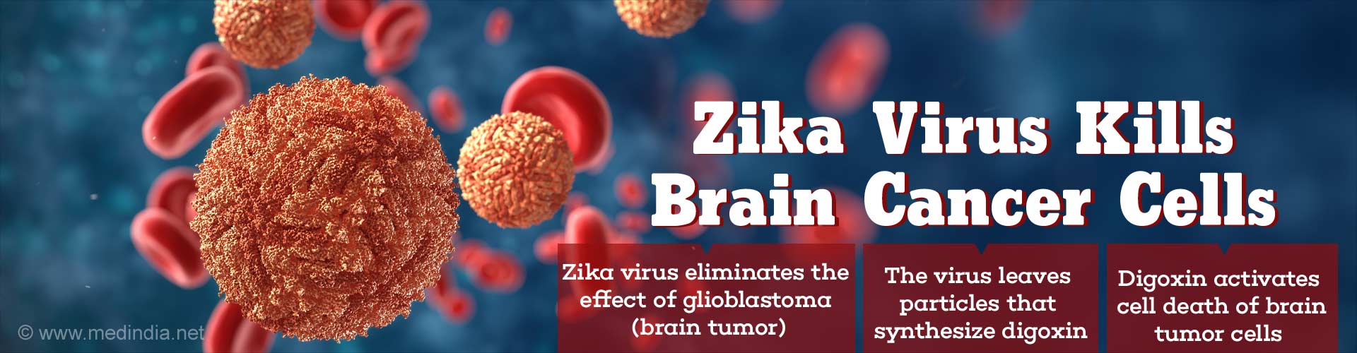 Zika Virus can Kill Brain Tumor