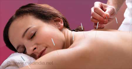 Acupuncture Can Help You Cope With Menopausal Symptoms