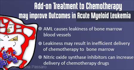 Add-on Treatment to Chemotherapy May Improve Acute Myeloid Leukemia Results
