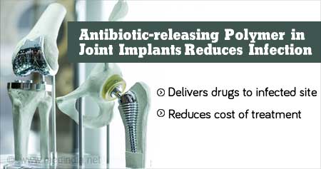 New Method To Reduce Joint Implant Infection