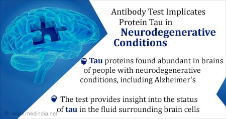 New Antibody Test to Detect Proteins Implicated in Neurodegenerative Conditions
