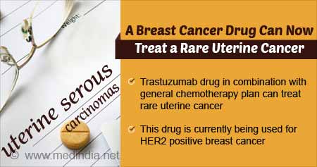 Rare Uterine Cancer Can Be Treated With a Breast Cancer Drug