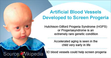 Blood Vessels Developed to Screen Progeria
