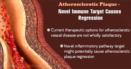 Key Immune Reaction to Reverse Arterial Disease