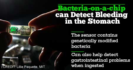 Bacteria-on-a-chip can Detect Bleeding in the Stomach