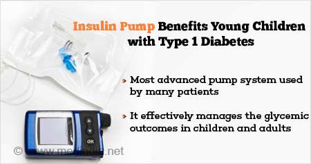 胰岛素泵对1型糖尿病儿童的益处
