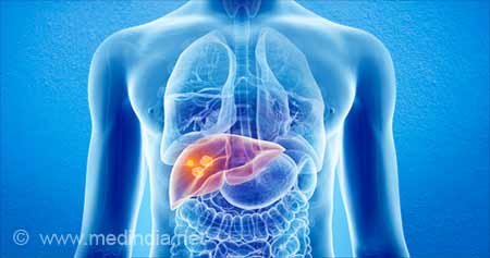Blood Transfusion during Liver Cancer Surgery may Lead to Recurrence of Cancer and Death