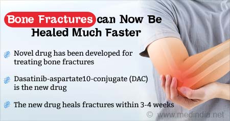 New Targeted Therapy for Bone Fractures Developed