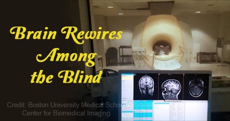 Improved Imaging Techniques in Brains of The Blind