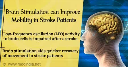 Brain Stimulation can Improve Mobility in Stroke Patients
