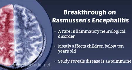 Autoimmune Disease: Rasmussen''s Encephalitis