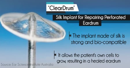 Silkworms that Repair Damaged Eardrums