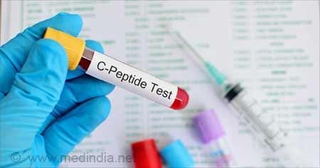 c肽检测有助于糖尿病的准确诊断和治疗