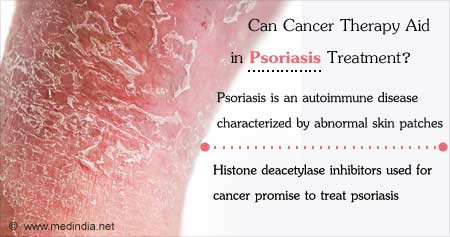How Cancer Therapy Can Aid in Psoriasis Treatment