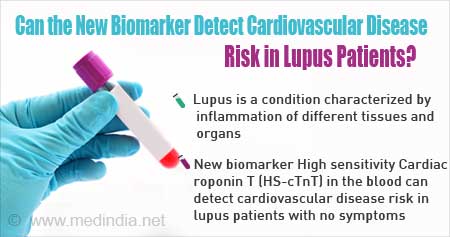Biomarker that Detects Heart Disease Risk in Lupus Patients